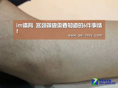 im体育_宫颈筛查需要知道的6件事情!(图2) im体育下载